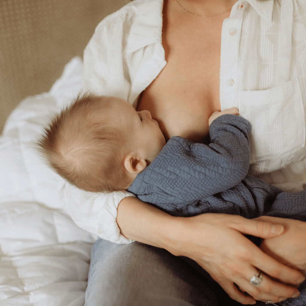 Breast Engorgement in Breastfeeding Mothers - Breastfeeding